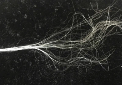 A nylon monofil nem abszorbeálható? A teljes útmutató az egészségügyi szakemb...